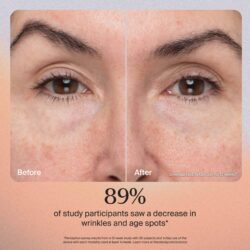 Therabody TheraFace PRO – Dispositivo Facial Multifuncional - Imagem 4